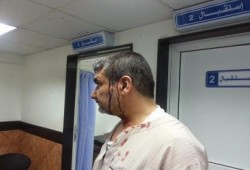 شرطة الانقلاب تعتدى على "لاجئين سوريين" محتجزين بالإسكندرية