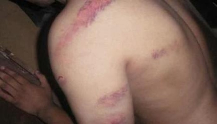 تعذيب معتقلين بقسم شبين الكوم على أيدى الانقلابيين