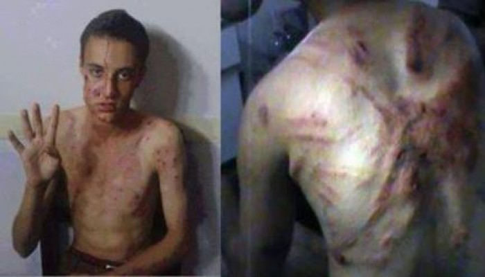 خبراء: الشرطة تقتل وتُعذب بحصانة من سلطة الانقلاب