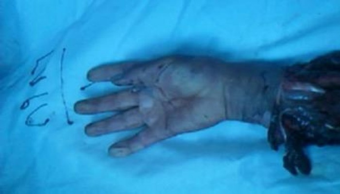 بالصور : الانفلات الأمني يسيطر علي الغربية وبلطجية يقطعون يد مواطن