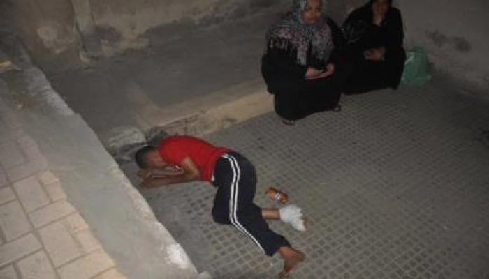 مستشفى "المعمورة" بالإسكندرية يرفض علاج مريض مبتور القدم ويطرده إلى الشارع