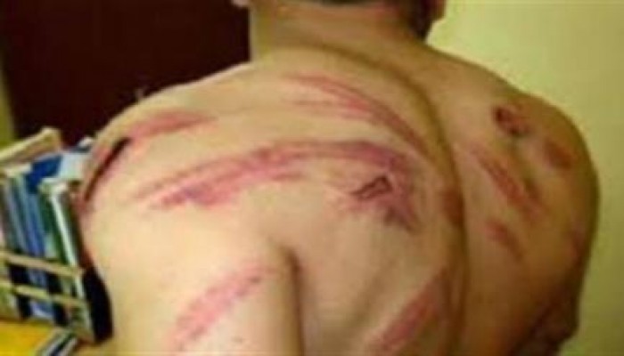 حبس 14 مواطنا بالدقهلية بعد تعذيبهم بقسم الشرطة