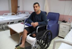 جرحى فلسطينيون في تركيا يحلمون بقضاء العيد في غزة