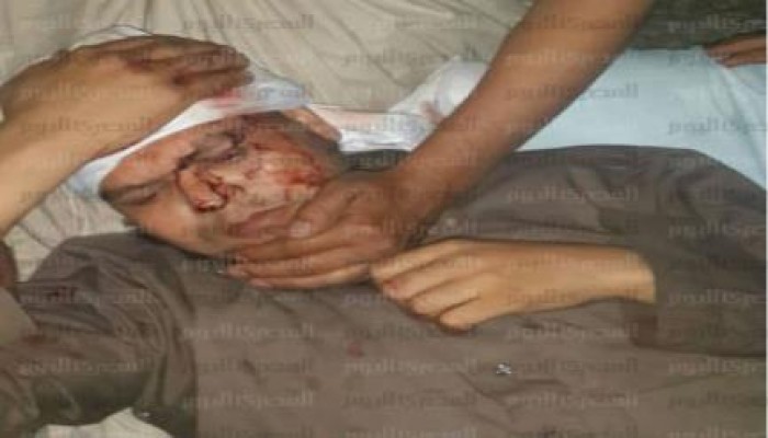 الأمن السعودي يعتدي علي الحجاج المصريين بالضرب