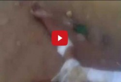 بالفيديو.. مستشفى أسوان تلقي بمريض في الشارع