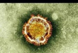 سلطات مطار أسوان تحتجز حاجا للاشتباه بإصابته بـ "كورونا"