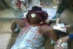 منظمة حقوقية تطالب بتحقيق مستقل فى مقتل طالب هندسة الإسكندرية