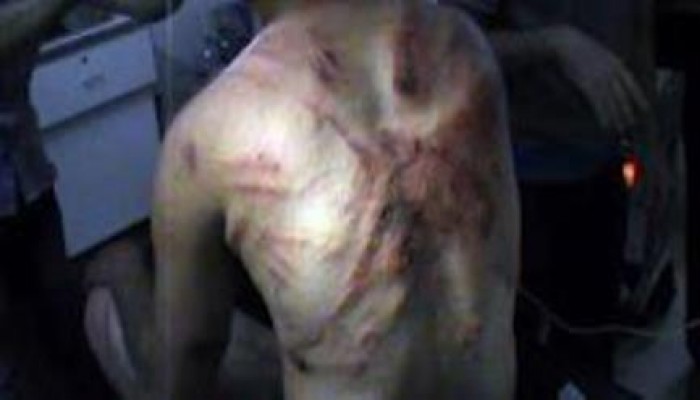 أسر المعتقلين تكشف وقائع تعذيب بدني بأسوان