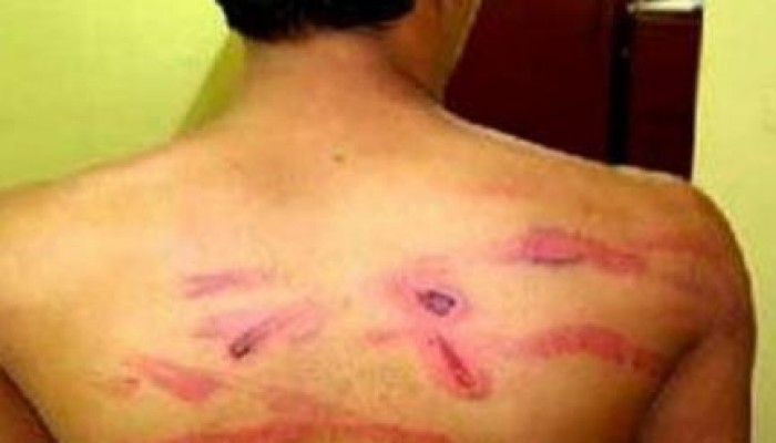 شرطة الإسماعيلية تعذب المعتقل محمد اسماعيل بالكرباج