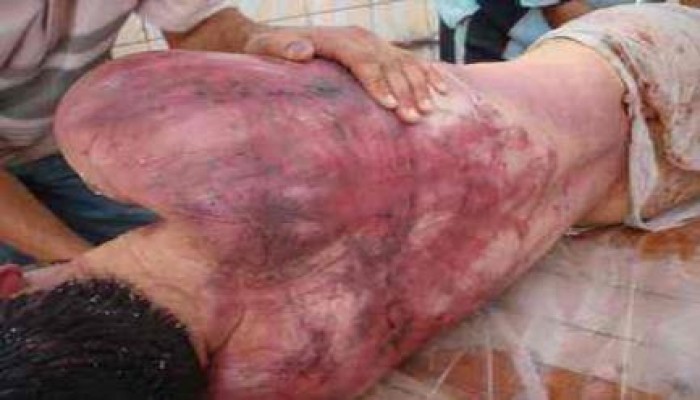 قائمة سوداء بأسماء 38 ضابطا تورطوا فى تعذيب معتقلي الشرعية