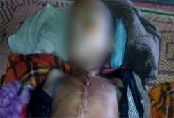 أطباء بوذيون ينتزعون أحشاء طفل من مسلمي الروهينجا في ميانمار