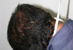 نحس الانقلاب: انتحار شاب شنقًا بمنطقة خورشيد بالإسكندرية