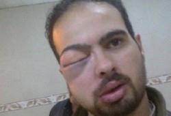 مركز حقوقي بالمنيا يكشف عن واقعتي تعذيب علي يد أفراد من الشرطة