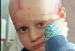 باحث مصري أزهري يخترع علاج للسرطان باستخدام الأوكسجين