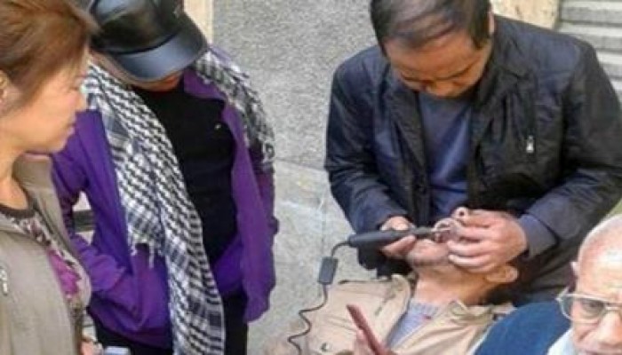 "أطباء السويس" يحذرون من أسنان وضروس الصينيين