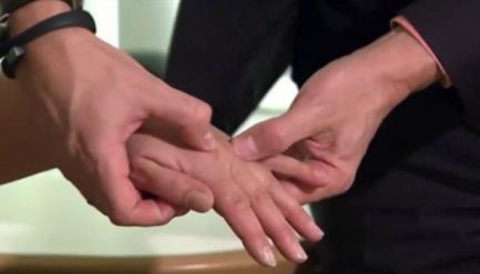 علاج يقضي على التهاب المفاصل دون عقاقير