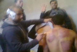 تعذيب ممنهج لـ3 من مؤيدي الشرعية بسلخانة قسم شبين