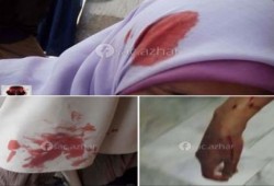 ميليشيا الخائن بالخانكة تعتدي بالضرب والسحل على 3 طالبات