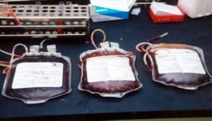 التقارير الرسمية تعترف بوجود أزمة في توفير أكياس الدم