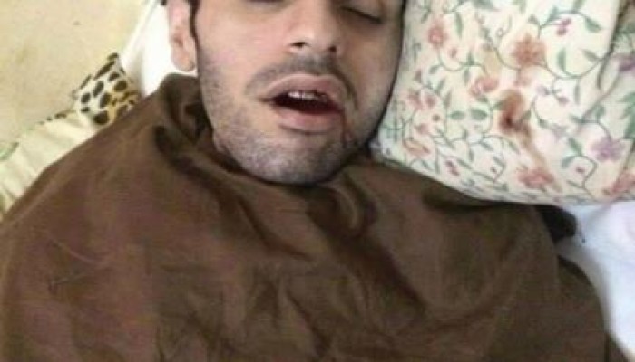 "سلطان" يتم عامًا كاملاً مُضربًا عن الطعام