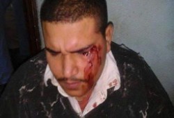 مدير بشركة "مصر للغزل والنسيج"بكفر الدوار يعتدى بالضرب على أحد العاملين