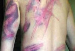 تقرير حقوقي: 45 شاب مصري يتعرضون لأبشع أنواع التعذيب بالإسكندرية