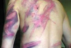 خلال يناير الماضى: 303 حالات عنف وانتهاك لحقوق الطفل