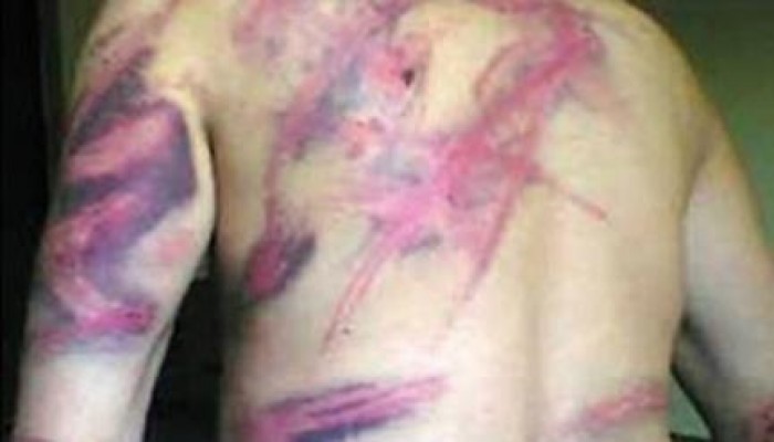 خلال يناير الماضى: 303 حالات عنف وانتهاك لحقوق الطفل