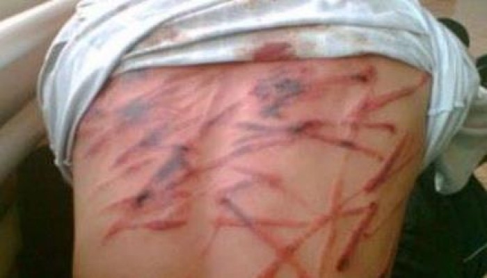 والدة "طفل دكرنس": سمعت صراخ ابني من التعذيب داخل المعتقل