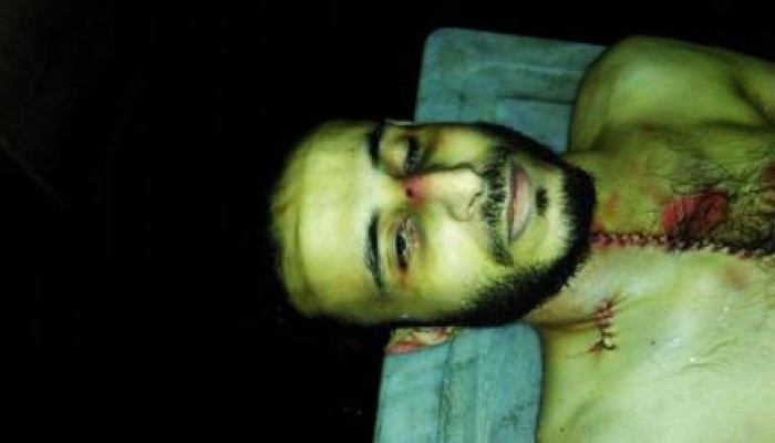 بالصور.. آثار التعذيب على شهيد المطرية عقب وفاته