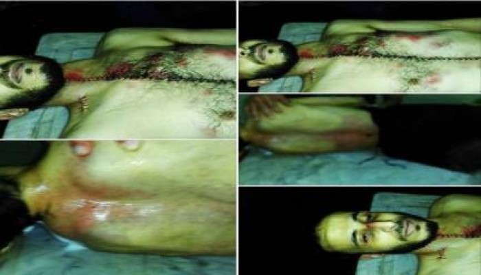 قسم شرطة المطرية ... مقبرة للأحياء