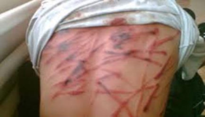 الاسكندرية : تعذيب عدد من المعتقلين فى "سلخانة الدور الرابع" للاعتراف بتهم لم يرتكبوها