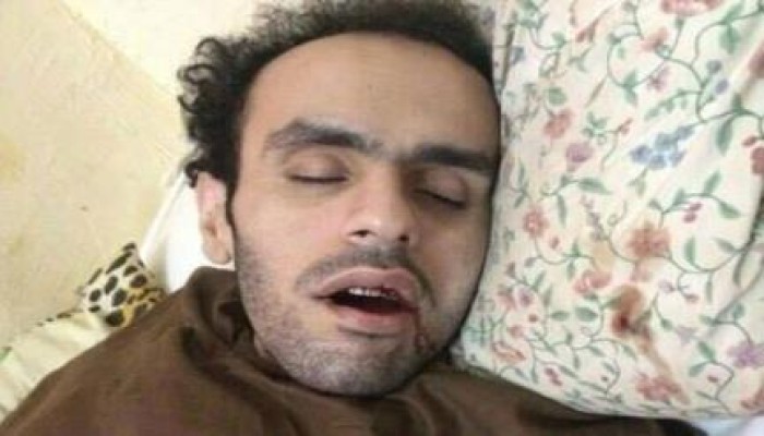إضراب محمد سلطان يدخل يومه الـ411