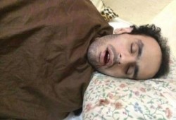 البطل الصامد " محمد سلطان " يدخل في إضراب لليوم الـ 424 على التوالي