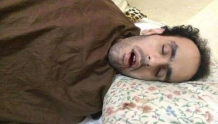 البطل الصامد " محمد سلطان " يدخل في إضراب لليوم الـ 424 على التوالي