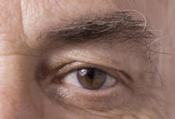 مليون مصري في طريقهم للإصابة بالعمى بسبب المياه الزرقاء