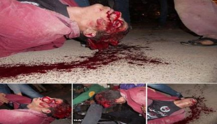 ارتقاء شهيد برصاص أمن الانقلاب خلال الاعتداء على تظاهرة بالمعادي