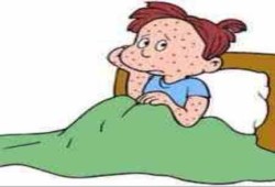 كوارث الإنقلاب.. إصابة 21 تلميذا بالجديرى المائى فى أسوان