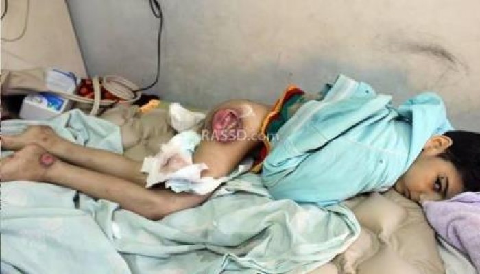 أم مكلومة تحكي مأساة فلذة كبدهاالوحيد الذي بات عاجزا بيد الإهمال الطبي