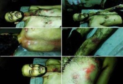 تقرير الطب الشرعي يثبت وفاة "كريم" داخل قسم المطرية جراء التعذيب