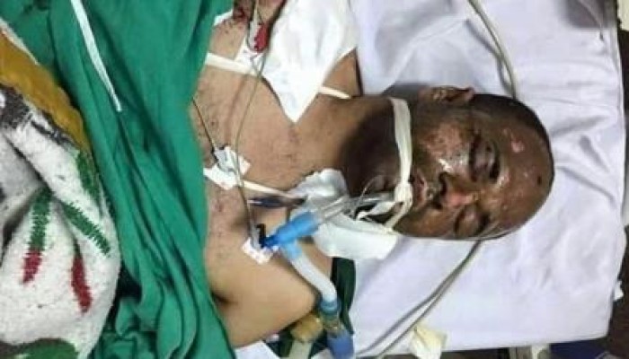 كلاب الانقلاب يتبرأون  من دماء "نصر".. والأهالي: قتل تحت وطأة التعذيب   .