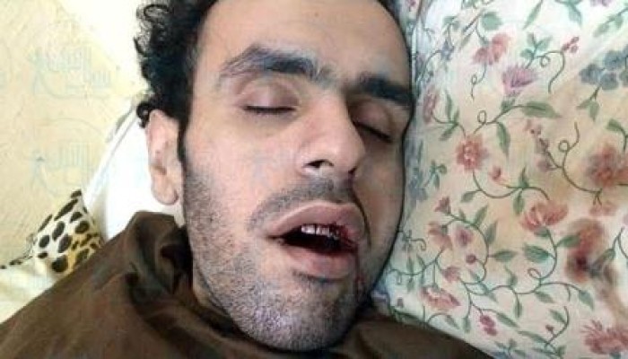 سلطان يواصل إضرابه لليوم الـ 482 وحالته تزداد خطورة