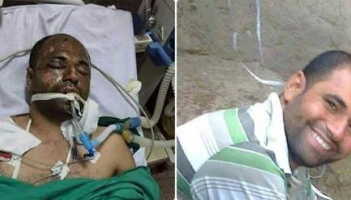 أمن الانقلاب يختطف مواطنًا من على أجهزة التنفس بمستشفى في الإسكندرية