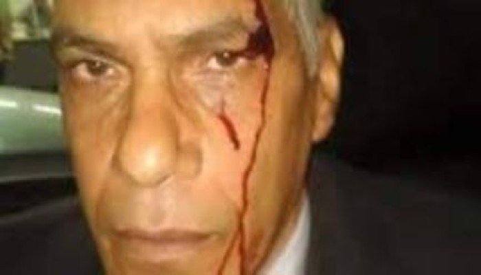 المحامى المعتدى عليه: لا تصالح مع الداخلية ودمي في رقبة "عاشور"