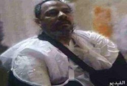 استغاثة حقوقية: أنقذوا طلعت من "طره" قبل بتر ذراعيه