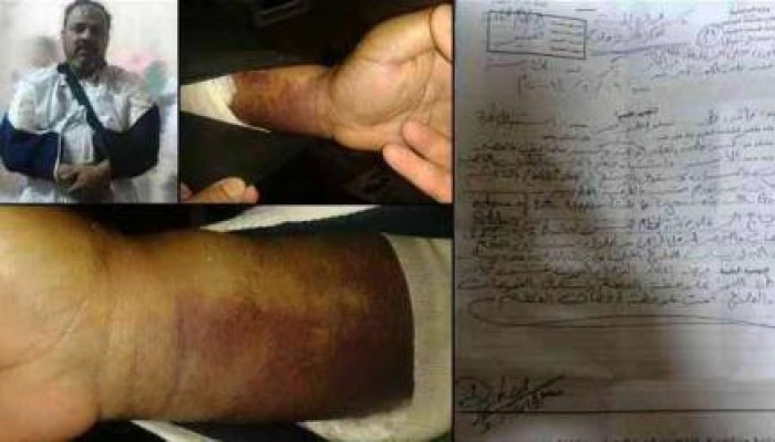 "الأوروبي" يرسل استغاثة قبل بتر ذراعيْ "طلعت" في طره