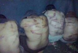 سلخانات العسكر تتحدى "حقوق الإنسان".. و"الموت البطيء أهم إنجازات الانقلاب