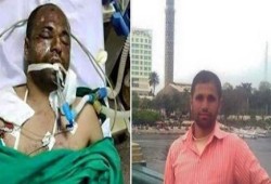 تدهور صحة المعتقل أحمد نصر والاطباء تؤكد حدوث غرغرينة وإصابته بفقدان جزئي في الذاكرة