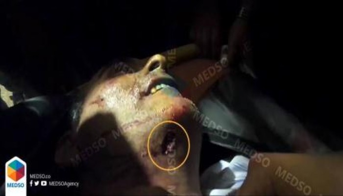 عاجل .. صورة تفضح الداخلية وتثبت أن الانقلاب قتل قيادات الإخوان عن عمد دون أي اشتباك