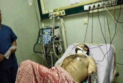 تدهو الحالة الصحية لمحامي "مدينة نصر" ومحامون يقررون الإضراب